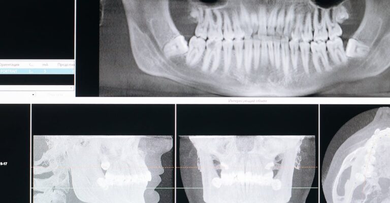 Smile Brighter With These Teeth Whitening Tips